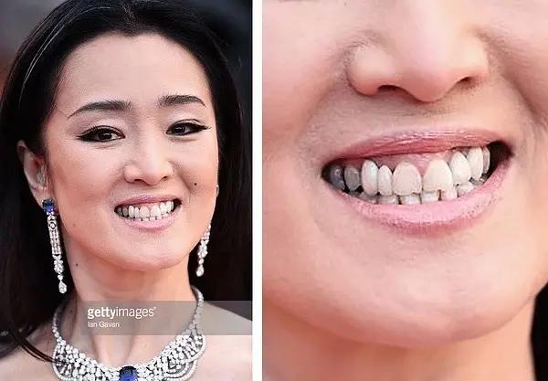 烤瓷牙齒價格表,時代的印記與變遷