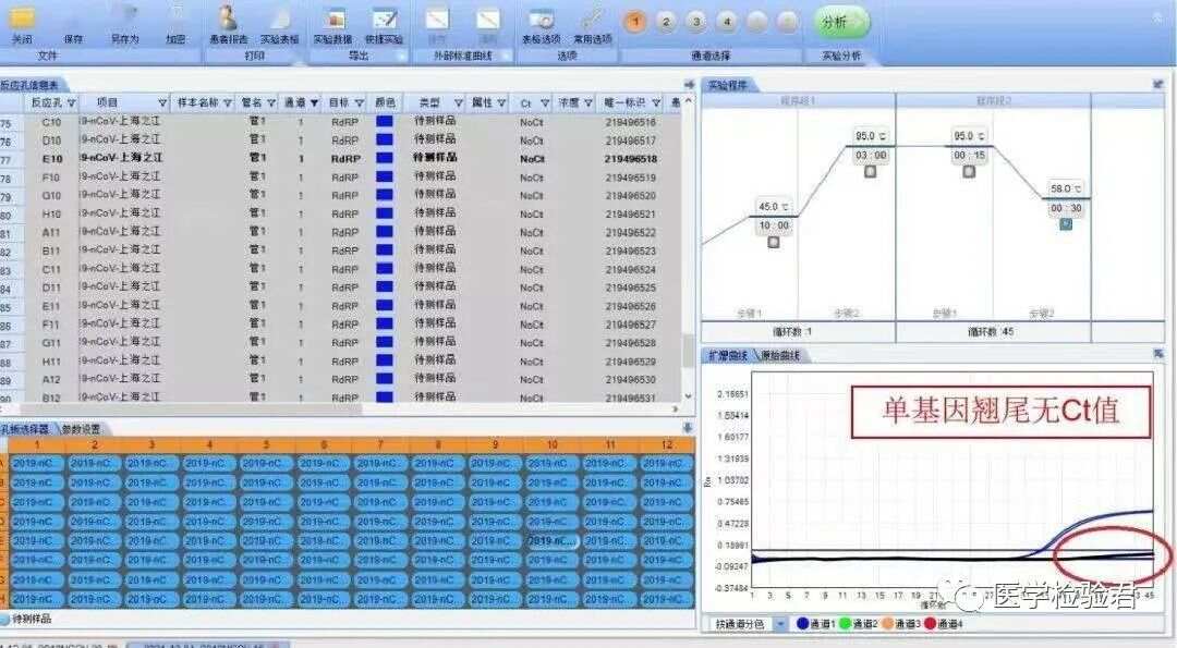 "管家婆的資料一肖中特985期"的:系統分析方案設計_精選版7.34