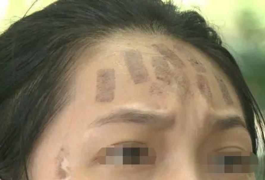 成都光子嫩膚價格，科技重塑肌膚之美