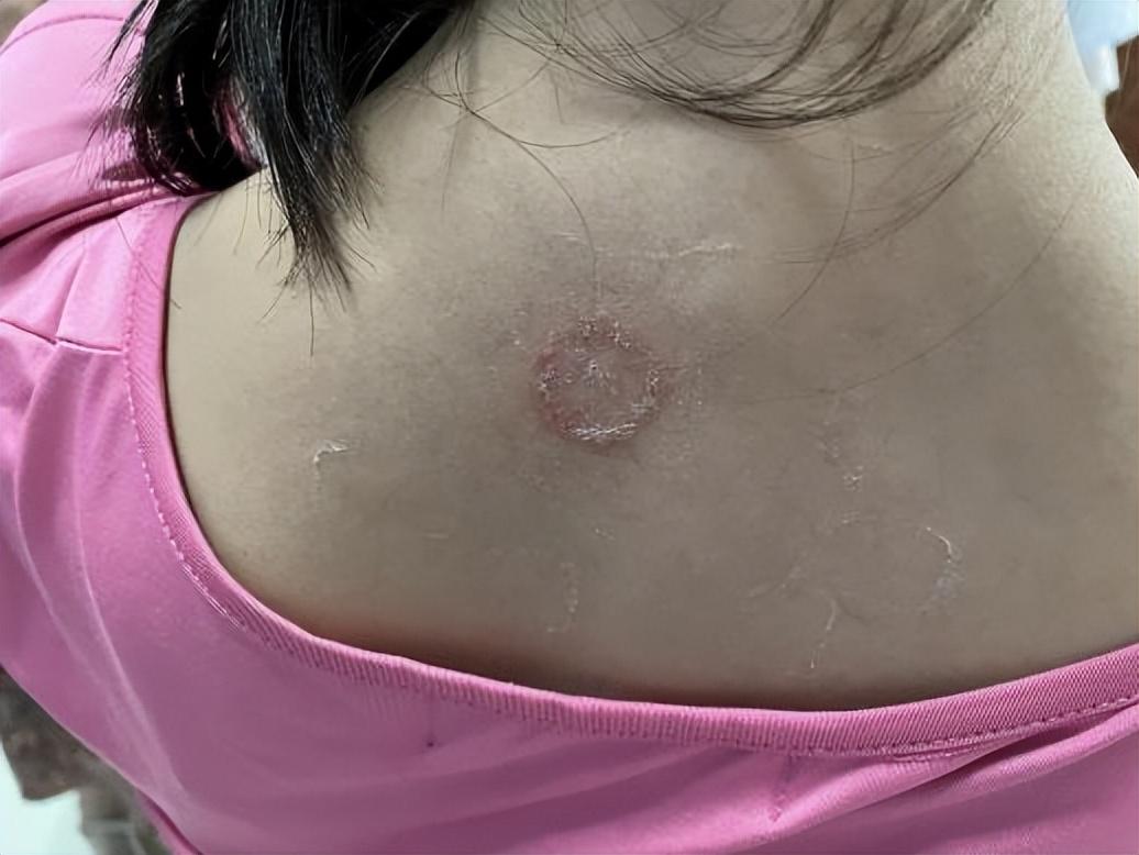 尤卓爾軟膏價格大解密，重磅揭秘真實價格??