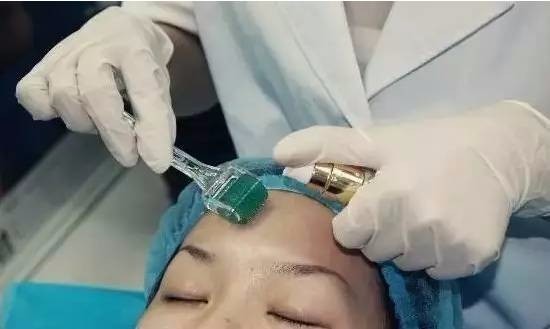 果酸換膚成本與代價揭秘，美麗背后的價格標簽