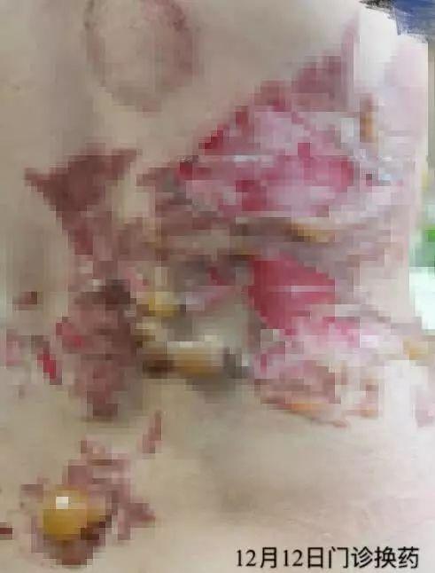 小巷特色養生館，最新拔罐圖片分享