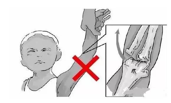 軟骨發育不全最新治療及步驟指南解析